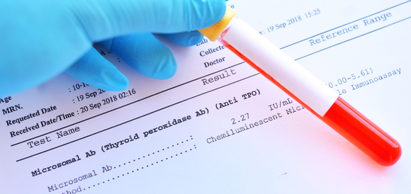 בדיקת נוגדנים לתירוגלובולין בדם (Thyroglobulin Antibodies) - תמונה